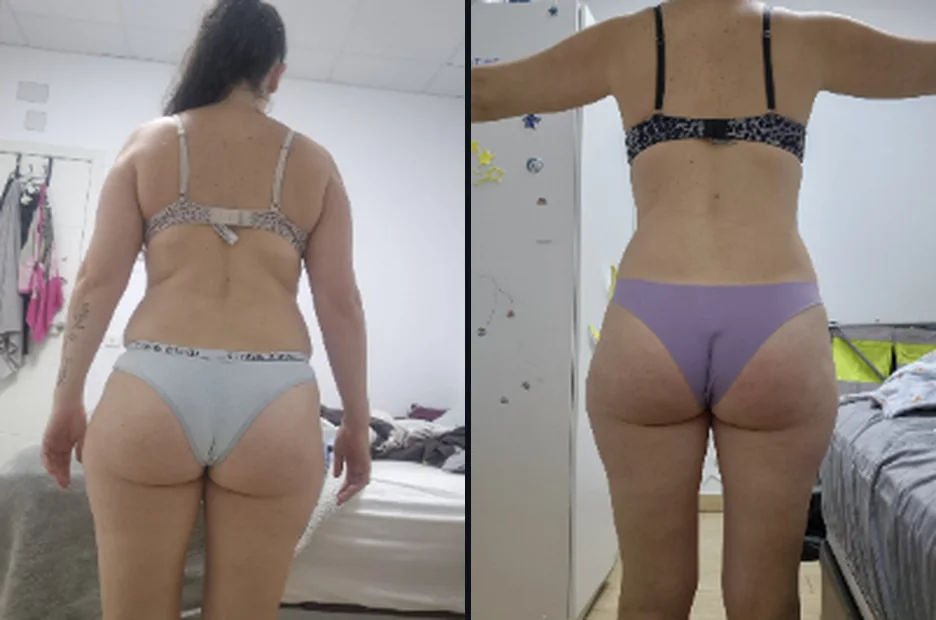 Natalia · espalda, antes y hoy