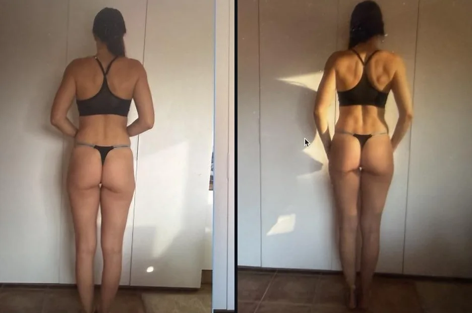 Sonia · espalda, antes y hoy
