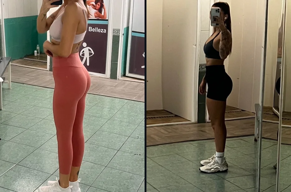 Alumna · glúteo, antes y hoy