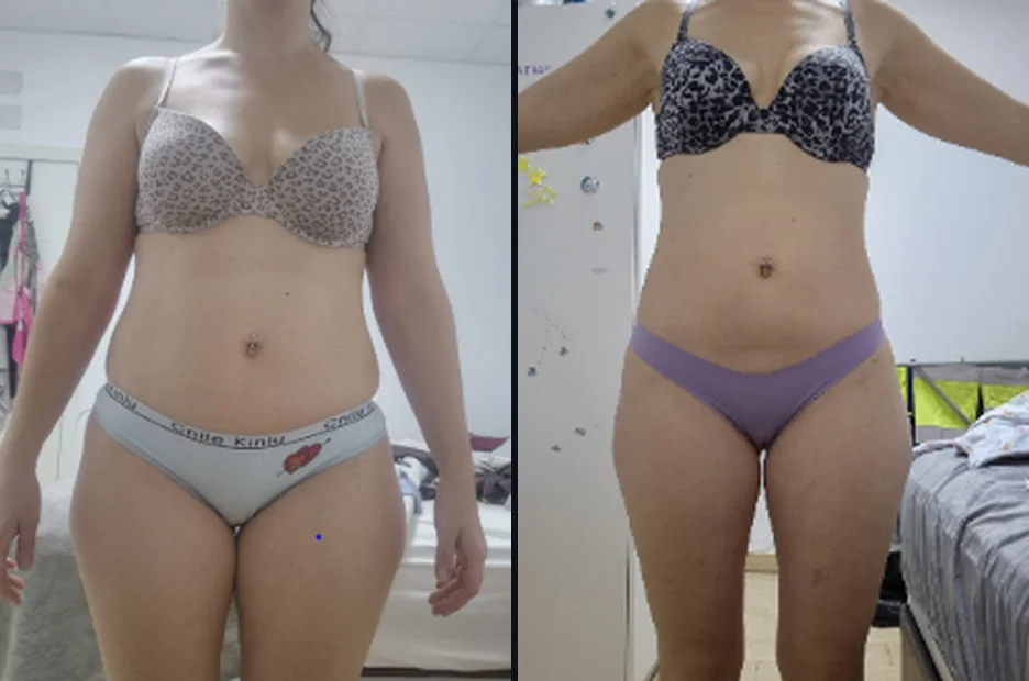 Natalia · 34, antes y hoy