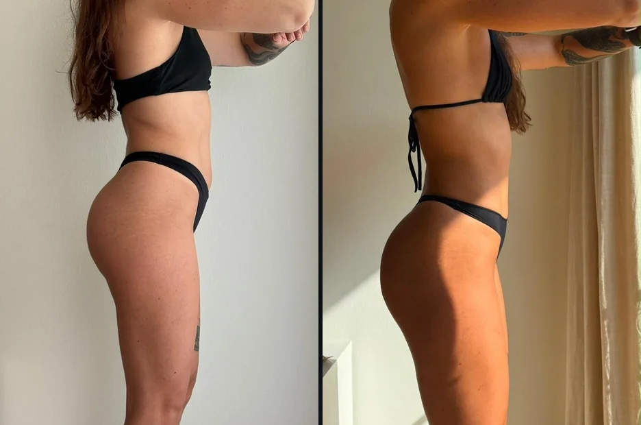 Leire · perfil, antes y hoy